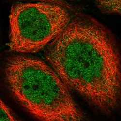 CCDC113 Antibody, Novus Biologicals 0.1mL; Unlabeled:Antibodies, Polyclonal